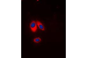 Immunofluorescent analysis of p47 phox (pS359) staining in HeLa cells. (NCF1 抗体  (C-Term, pSer359))