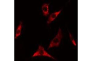 ABIN6275318 staining A549 cells by IF/ICC. (NARFL 抗体  (Internal Region))