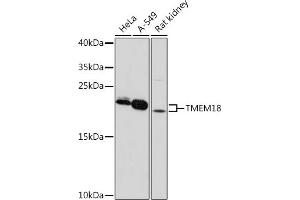 Western blot analysis of extracts of various cell lines, using TMEM18 pAb (ABIN7270961) at 1:1000 dilution. (Transmembrane Protein 18 (TMM18) (AA 40-100) 抗体)