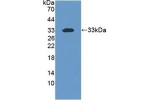 Detection of Recombinant CIDEC, Human using Polyclonal Antibody to Cell Death Inducing DFFA Like Effector C (CIDEC) (CIDEC 抗体  (AA 1-251))
