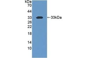 Detection of Recombinant CIDEC, Human using Polyclonal Antibody to Cell Death Inducing DFFA Like Effector C (CIDEC)