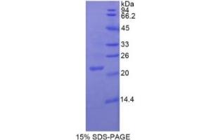 SDS-PAGE of Protein Standard from the Kit (Highly purified E. (ENOS ELISA 试剂盒)