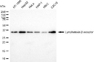 anti-Lymphotoxin beta Receptor (TNFR Superfamily, Member 3) (LTBR) antibody
