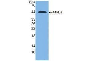 Detection of Recombinant AST, Human using Polyclonal Antibody to Aspartate Aminotransferase (AST) (GOT1 抗体  (AA 1-413))