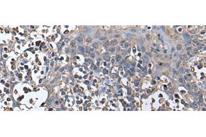 Immunohistochemistry (Paraffin-embedded Sections) (IHC (p)) image for anti-Zinc Finger, HIT-Type Containing 1 (ZNHIT1) antibody (ABIN7245752)