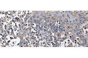 Immunohistochemistry of paraffin-embedded Human tonsil tissue using ZNHIT1 Polyclonal Antibody at dilution of 1:40(x200) (ZNHIT1 抗体)