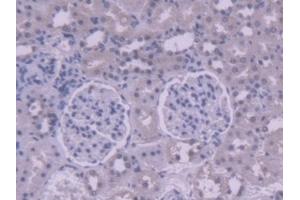 Detection of AGXT2 in Rat Kidney Tissue using Polyclonal Antibody to Alanine Glyoxylate Aminotransferase 2 (AGXT2) (AGXT2 抗体  (AA 225-512))