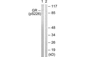 Western Blotting (WB) image for anti-GR (Internal Region), (pSer226), (pSer234), (pSer246) antibody (ABIN1847260) (GR (Internal Region), (pSer226), (pSer234), (pSer246) 抗体)