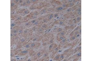 Used in DAB staining on fromalin fixed paraffin- embedded liver tissue (ACADL 抗体  (AA 214-430))