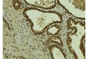 ABIN6274458 at 1/100 staining Mouse colon tissue by IHC-P.