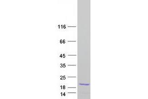 Western Blotting (WB) image for MYC Associated Factor X (MAX) (Transcript Variant 3) protein (Myc-DYKDDDDK Tag) (ABIN2725571)