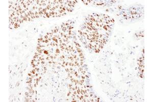 Immunohistochemistry (IHC) image for anti-PSME3 (PSME3) (AA 204-254) antibody (ABIN7454979) (PSME3 抗体  (AA 204-254))