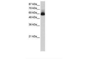 Image no. 1 for anti-Zinc Finger Protein 307 (ZKSCAN4) (N-Term) antibody (ABIN202739)