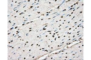 Immunohistochemical staining of paraffin-embedded liver tissue using anti-BSG mouse monoclonal antibody. (CD147 抗体)