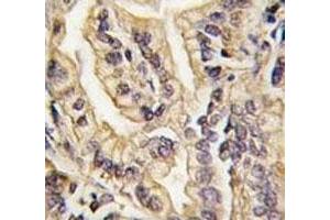 Immunohistochemistry (IHC) image for anti-Colony Stimulating Factor 1 Receptor (CSF1R) (AA 940-971) antibody (ABIN3030557)