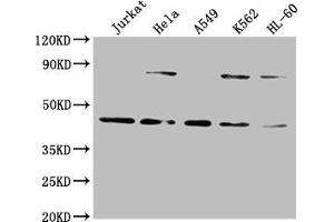 Western Blot Positive WB detected in: Jurkat whole cell lysate, Hela whole cell lysate, A549 whole cell lysate, K562 whole cell lysate, HL60 whole cell lysate All lanes: LMX1A antibody at 1:2000 Secondary Goat polyclonal to rabbit IgG at 1/50000 dilution Predicted band size: 43, 15 kDa Observed band size: 43 kDa (LMX1A 抗体  (AA 9-86))