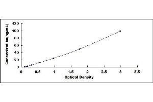 Ferritin, Light Polypeptide (FTL) ELISA Kit