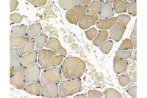ABIN7096915 and ABIN7100981 at 1/100 staining rat muscle tissue by IHC-P. (SGK196 抗体)