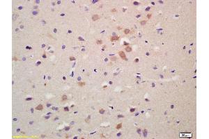 Formalin-fixed and paraffin embedded rat brain labeled with Anti-GRK1 Polyclonal Antibody, Unconjugated (ABIN737391) at 1:200 followed by conjugation to the secondary antibody and DAB staining. (GRK1 抗体)