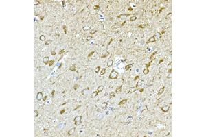 Immunohistochemistry of paraffin-embedded rat brain using GPLD1 Rabbit pAb (ABIN6131716, ABIN6141335, ABIN6141336 and ABIN6222300) at dilution of 1:100 (40x lens). (GPLD1 抗体  (AA 24-160))