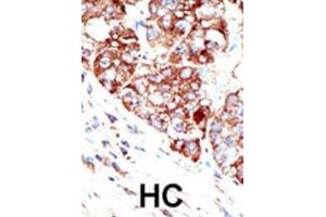 Immunohistochemistry (IHC) image for anti-Protein Inhibitor of Activated STAT, 1 (PIAS1) antibody (ABIN2996746) (PIAS1 抗体)