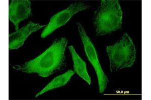 Immunofluorescence of monoclonal antibody to MAPK12 on HeLa cell.