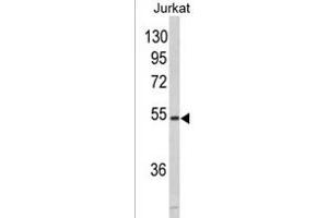 Western blot analysis of MF 928b in Jurkat cell line lysates (35 μg/lane). (MFAP1 抗体  (N-Term))
