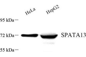 Western blot analysis of SPATA13 (ABIN7075700) at dilution of 1: 500 (SPATA13 抗体)