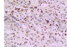 Formalin-fixed and paraffin embedded rat colon tissue labeled with Anti-PAF Polyclonal Antibody, Unconjugated (ABIN737931) at 1:200 followed by conjugation to the secondary antibody and DAB staining (KIAA0101 抗体)