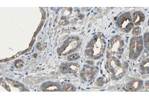 ABIN6275481 at 1/100 staining Human prostate tissue by IHC-P. (RGS5 抗体  (Internal Region))