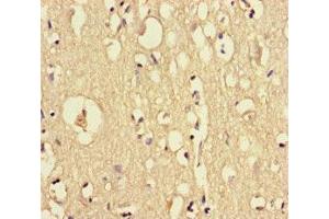 Immunohistochemistry of paraffin-embedded human brain tissue using ABIN7149595 at dilution of 1:100 (DOCK6 抗体  (AA 499-616))