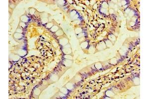 Immunohistochemistry of paraffin-embedded human small intestine tissue using ABIN7173221 at dilution of 1:100 (TMEM44 抗体  (AA 269-439))