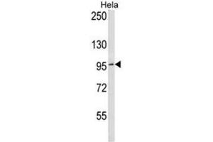 BCL6 Antibody (C-term) western blot analysis in Hela cell line lysates (35µg/lane). (BCL6 抗体  (C-Term))