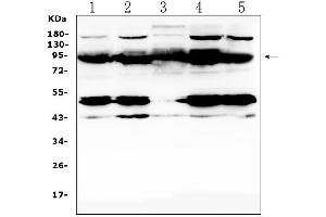 Western blot analysis of PTPN22 using anti-PTPN22 antibody (ABIN5693124).