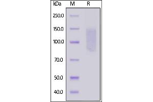 SDS-PAGE (SDS) image for CD96 (CD96) (AA 22-503) (Active) protein (His tag) (ABIN6253681)