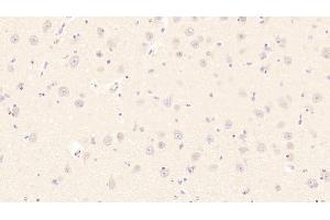 Detection of HSPA1B in Bovine Cerebrum Tissue using Monoclonal Antibody to Heat Shock 70 kDa Protein 1B (HSPA1B) (HSPA1B 抗体  (AA 1-641))