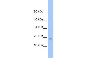 WB Suggested Anti-LOC285033 Antibody Titration: 0. (LOC285033 抗体  (N-Term))