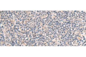 Immunohistochemistry of paraffin-embedded Human tonsil tissue using IDUA Polyclonal Antibody at dilution of 1:35(x200) (IDUA 抗体)