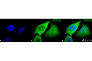 Immunocytochemistry/Immunofluorescence analysis using Rabbit Anti-HO-1 Polyclonal Antibody . (HMOX1 抗体  (PE))
