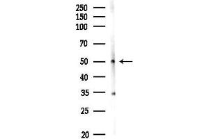 anti-Carboxypeptidase B1 (Tissue) (CPB1) (C-Term) antibody