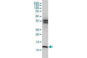 Western Blotting (WB) image for anti-Cystatin B (Stefin B) (CSTB) (AA 1-98) antibody (ABIN560508)