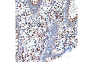 Immunohistochemistry of paraffin-embedded human appendix using LM Rabbit mAb (ABIN7268205) at dilution of 1:100 (40x lens). (LMAN1 抗体)