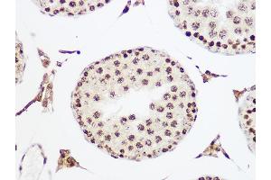 Immunohistochemistry of paraffin-embedded rat testis using MCM5 Rabbit mAb (ABIN7268543) at dilution of 1:100 (40x lens). (MCM5 抗体)