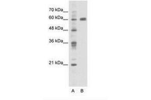 Image no. 1 for anti-PDZ and LIM Domain 5 (PDLIM5) (C-Term) antibody (ABIN202798) (PDLIM5 抗体  (C-Term))