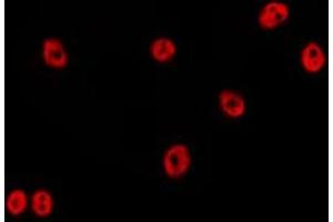 ABIN6278648 staining HepG2 by IF/ICC. (ZNF23 抗体)