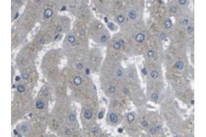 IHC-P analysis of Human Liver Tissue, with DAB staining. (ARPC4 抗体  (AA 3-165))
