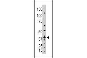 The GDF1 polyclonal antibody  is used in Western blot to detect GDF1 in A-375 cell lysate. (GDF1 抗体  (N-Term))