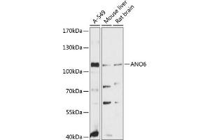 Western blot analysis of extracts of various cell lines, using  antibody (ABIN6129707, ABIN6136907, ABIN6136908 and ABIN6215620) at 1:3000 dilution. (Anoctamin 6 抗体  (AA 750-830))