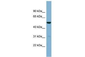 SDSL antibody used at 1 ug/ml to detect target protein. (SDSL 抗体  (Middle Region))