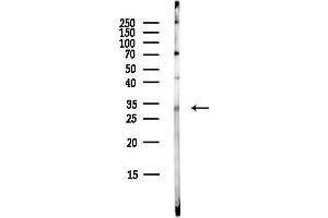 anti-Tocopherol (Alpha) Transfer Protein (TTPA) antibody